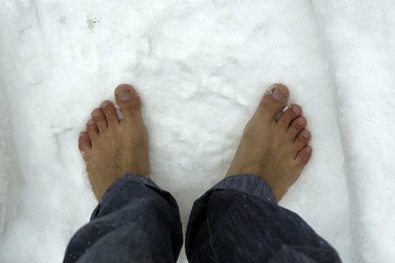 Ноги холодные сильные. Отморожение стопы 2 степени. Иммерсионное обморожение. Обморожение ступни 2 степени.