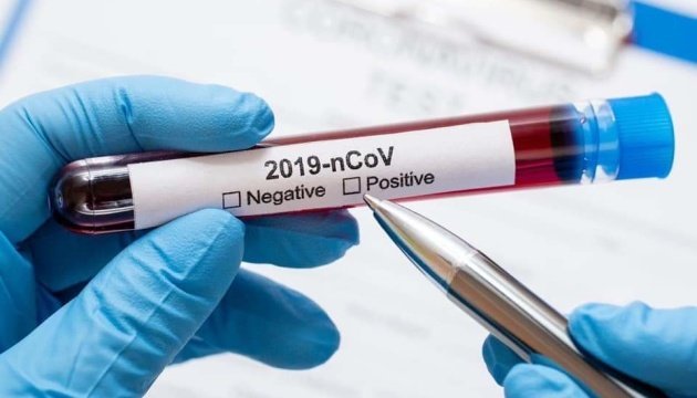 За добу зафіксували 112 нових випадків захворювання на COVID-19 на Херсонщині