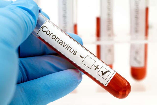 Ще 122 людини за добу на COVID-19 захворіли