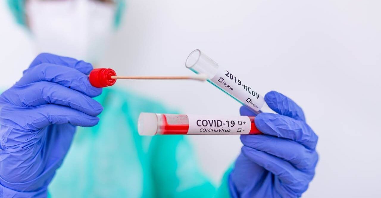 За добу діагностували 963 випадки захворювання на COVID-19 на Херсонщині