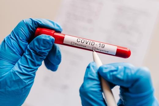 На Херсонщині за добу виявили 581 випадок COVID-19 захворювання
